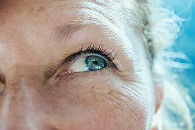 Cataracts Surgery in Fort Lauderdale